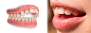 Dentistas Urgencias en Madrid Dentistas Urgencias en Madrid